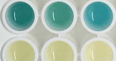 علماء يطورون اختبار بول يغير اللون للأزرق عند اكتشاف السرطان بالجسم