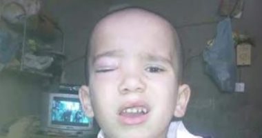 موجز محافظات مصر.. مشرفة حضانة تصيب طفلاً فى عينه بخرطوم