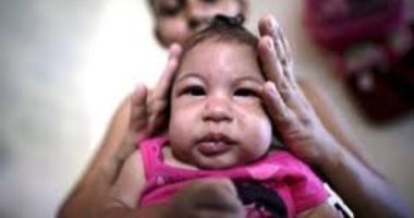 فيروس زيكا قد يهاجم الأطفال خلال السنة الأولى من حياتهم..دراسة تكشف 