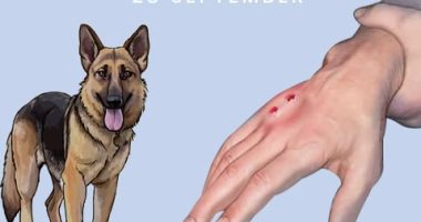 كل ما تريد معرفته عن داء الكلب والأعراض المصاحبة