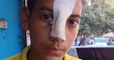 محضر ضد معلم بمدرسة ثانوى فى الشرقية بسبب ضرب طالب وسبه بالأم