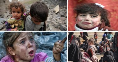 اليونيسيف: 16مليون طفل يعانون من سوء التغذية بالشرق الأوسط بسبب النزاعات