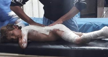 إصابة طفل سورى جراء قصف طائرات ‎الاحتلال التركى