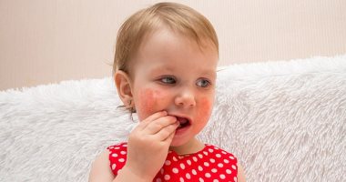 ما هو التهاب الأنف التحسسي عند الأطفال؟