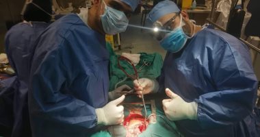 مستشفى مدينة نصر للتأمين الصحى يجرى جراحة نادرة بالقلب لمريض