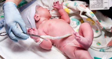 إجراء واحد فقط متعلق بالحبل السرى للجنين ينقذ آلاف الرضع من الوفاة