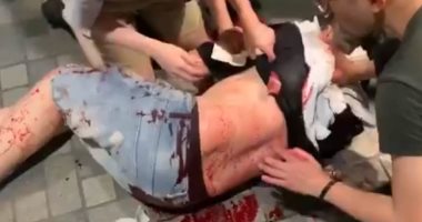 إصابة 4 أشخاص خلال هجوم بسكين فى هونج كونج.. وقطع أذن سياسى