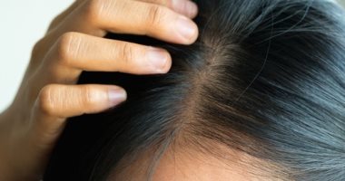 دراسة: بعض أنواع سرطان الجلد تبدأ من بصيلات الشعر
