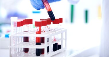 الصحة: تحليل PCR متوفر بالمعامل المركزية ويحدد وجود فيروس كورونا