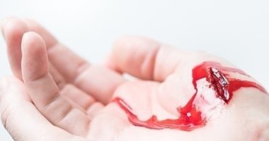 احذر.. تنظيف الأسنان قد يؤدى للإصابة بعدوى مجرى الدم