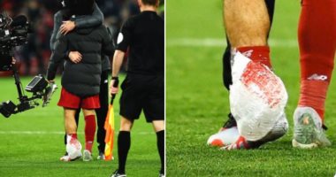 إصابة محمد صلاح فى مباراة مانشستر سيتي تثير قلق ليفربول
