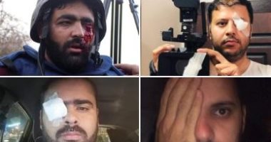 إعلاميون يتضامنون مع المصور معاذ عمارنة بعد فقد إحدى عيناه برصاصة إسرائيلية