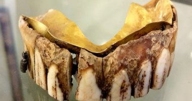 اكتشاف طقم أسنان بشرى مذهب عمره 200 عام فى إنجلترا.. اعرف الحكاية