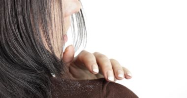 8 طرق لاستخدام عصير البصل فى القضاء على قشرة الشعر