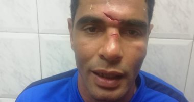 محمد صبحى حارس الداخلية يتعرض لجروح فى وجهه أثناء مباراة الترسانة