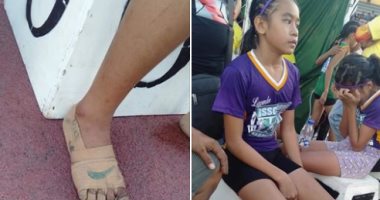 طفلة فلبينية تفوز بـ3 ميداليات ذهبية بدون حذاء وترسم علامة "نايك" على قدمها