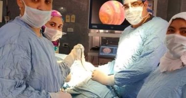 أطباء بنها الجامعى يجرون أول عملية استئصال لرئة بالمنظار الصدرى الجراحى