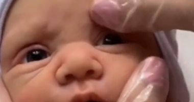 فيديو يفزع القلوب لخلع عين طفل.. والحقيقة "مقلب على تيك توك"