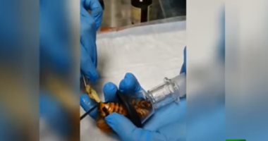 أطباء روس يساعدون أنثى صرصار على إنجاب 20 حشرة بعملية جراحية.. فيديو