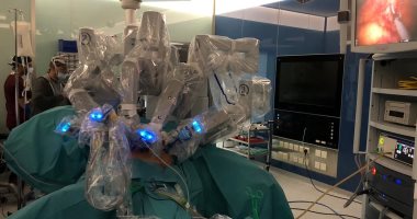 نجاح أول جراحة فى السعودية بواسطة "الروبوت"