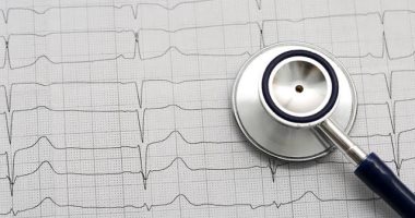 اطمن على نفسك..رسم القلب قد يطلبه طبيبك لتشخيص النوبة القلبية وحالات أخرى