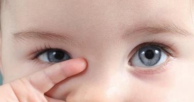 إهمال الحول عند الأطفال يؤثر على عضلات العين.. اعرف التفاصيل