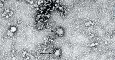 جونز هوبكنز: إصابات العالم بفيروس كورونا تتجاوز الـ405 ملايين حالة