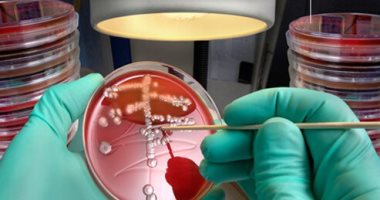 الخلايا المقاومة للبكتيريا في الشعب الهوائية تزيد من مخاطر الإصابة بالفيروسات
