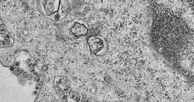 "بلومبرج" تنشر أول صور توضح كيفية تكاثر فيروس كورونا فى الخلايا