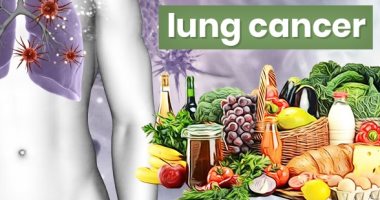 5 أطعمة لا تغفلها لتقليل خطر الإصابة بسرطان الرئة