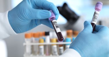 تحليل يساعد فى اكتشاف فقر الدم الناتج عن نقص فيتامين ب12