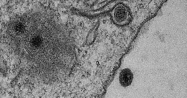 اكتشاف فيروس غامض لا يملك جينات يحير العلماء بالبرازيل 