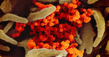 السعودية نيوز | 
                                            الصحة السعودية تسجل 5362 حالة إصابة جديدة بفيروس كورونا خلال 24 ساعة
                                        