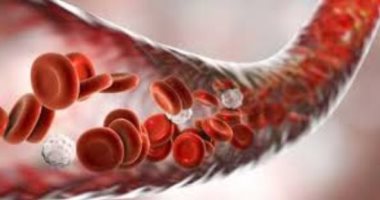 أفضل 5 علاجات طبيعية لعلاج فقر الدم الناجم عن نقص الحديد