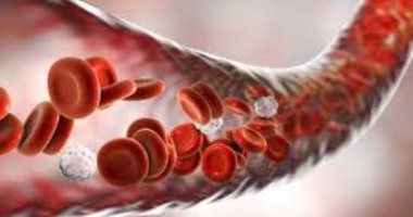 علاج جينى للأنيميا يغير الحمض النووى فى خلايا الدم