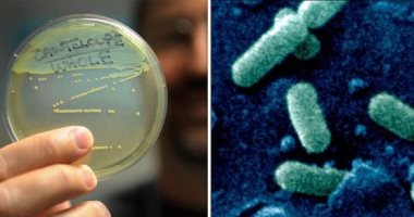 أسئلة وإجابات عن الإصابة بكتيريا الليستريا وأعراضها