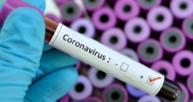 دواء لإلتهاب المفاصل قد يكون الحل لمخاوف العالم من فيروس كورونا
