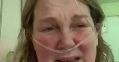 سيدة بريطانية تصاب بعدوى تعفن الدم الرئوى بعد تعافيها من كورونا.. فيديو