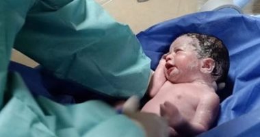 صور.. أطباء مستشفى إسنا للعزل بالأقصر يجرون ثالث ولادة قيصرية لمصابة بكورونا