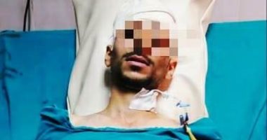 صور .. مستشفى سوهاج الجامعى ينقذ حياة شاب من طعنة بالقلب