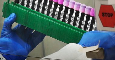 اختبار جديد للدم للسيطرة على كورونا يحدد الإصابة بالعدوى وتوقيت الإصابة 