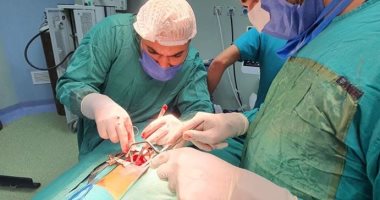 صور.. أطباء مستشفى أرمنت ينقذون طفلة 8 سنوات من صديد على الجهاز التنفسى