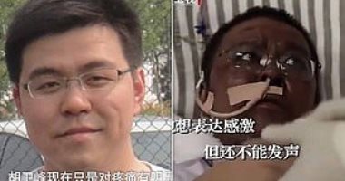 "5 شهور علاج".. وفاة الطبيب الصيني هو ويفينج بكورونا بعد تحول لون بشرته للأسود