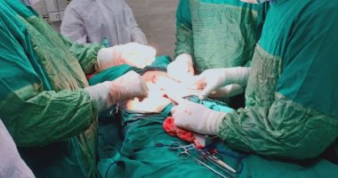 عملية جراحية لإصلاح ثقب بالأمعاء لحالة مصابة بكورونا فى مستشفى الأقصر.. صور