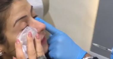هيدي كرم تشارك جمهورها بفيديو أثناء خضوعها لجلسة علاجية أسفل عينيها