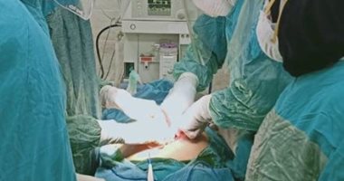 عملية جراحية دقيقة وإستئصال جزء من أمعاء مصابة بكورونا بمستشفى الأقصر.. صور