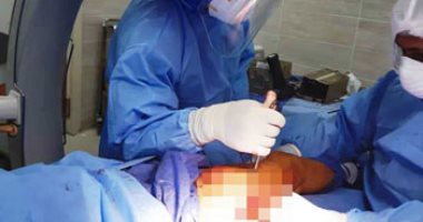 صور.. مستشفى الأقصر العام تجرى جراحة لتثبيت كسر بمفصل فخذ مريضة بـ"كورونا"