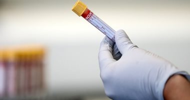 باحثون يتوصلون لـ اختبار دم يكشف الإصابة بالسرطان خلال 48 ساعة