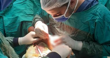صور.. مستشفى أرمنت التخصصى تنقذ مواطنا عقب إصابته بكسور فى يده بحادث سير 
