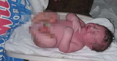 ولادة طفل باستخدام تقنيات التنويم المغناطيسى وزنه 5 كيلو جرام